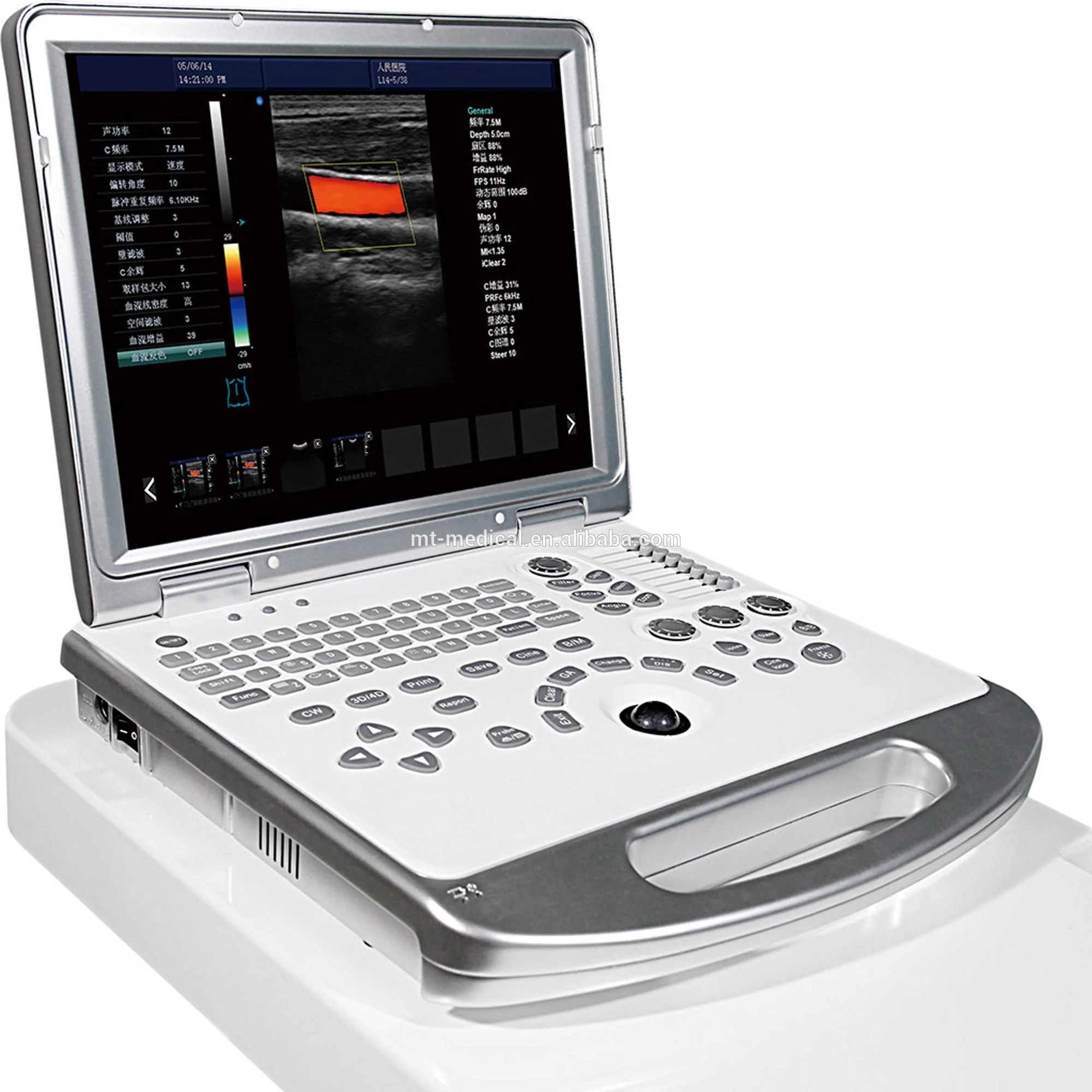 

Hot sales 4D color laptop doppler 128 elements portable ultrasound scanner machine with Real time 3D/4D, with CW