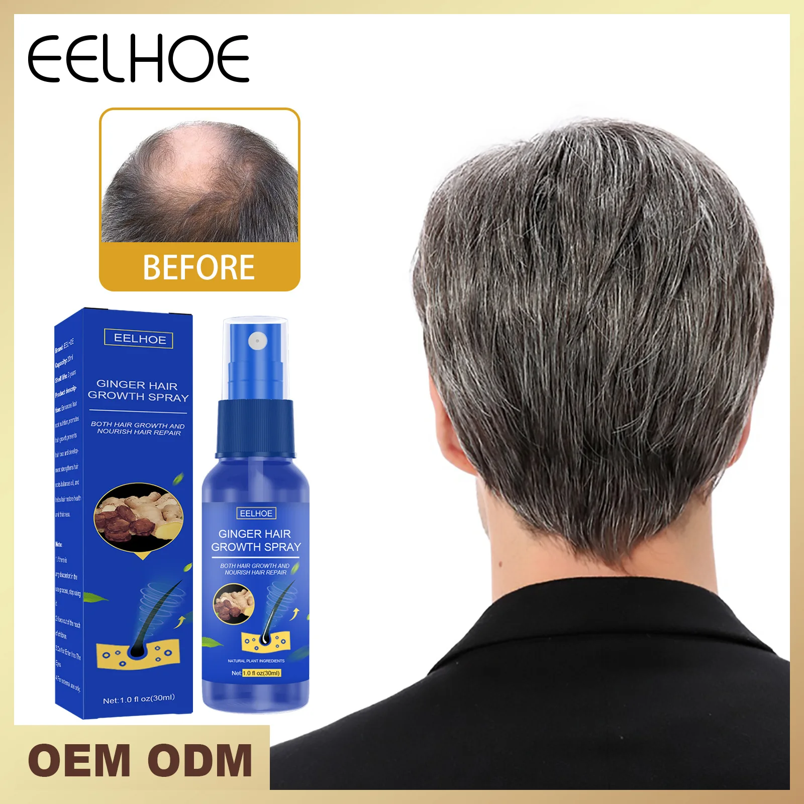 

EELHOE Ginger Hair Growth Spray Serum Anti Hair Loss Products Fast Grow Prevent Hair Dry Frizzy Damaged Thinning Repair Care