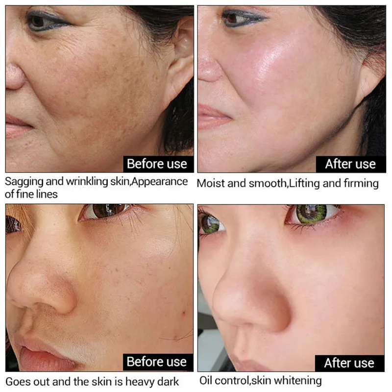 Сыворотка для удаления морщин и восстановления кожи |