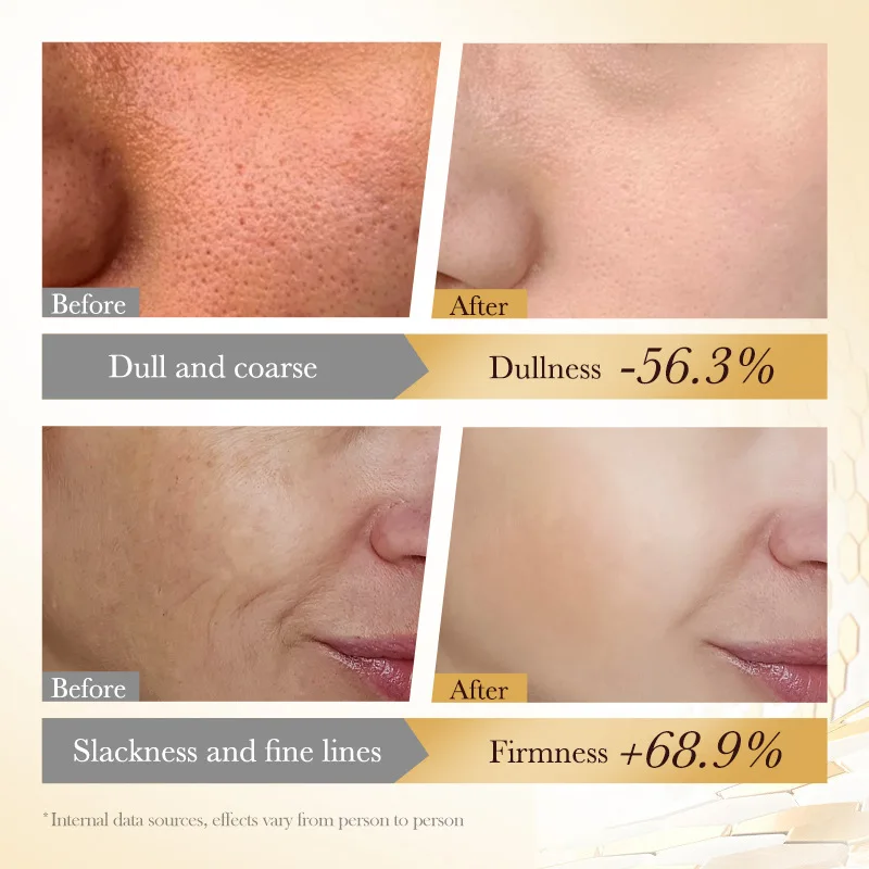 Очищающее средство для лица пчелиный яд пена ухода за кожей увлажнение контроль