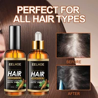 plant extracts hair growth serum hair loss products liquid health care beauty salon essential oil scalp treatment for men women