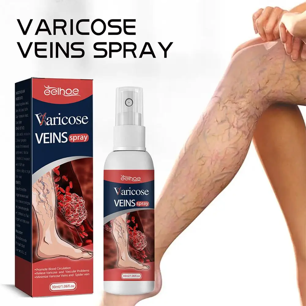 

30ml Varicose Vein Spray Effective Relieve Vasculitis Phlebitis Spider Pain Treatment Cream Ointment Relieve Soreness Swelling