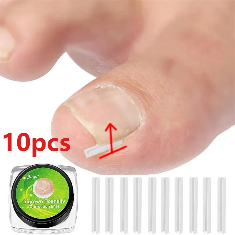 

10pcs Ingrown Toenail Correction Tool Invisible Ingrown Toe Nail Treatment Elastic Straightening Clip Brace Pedicure Tool