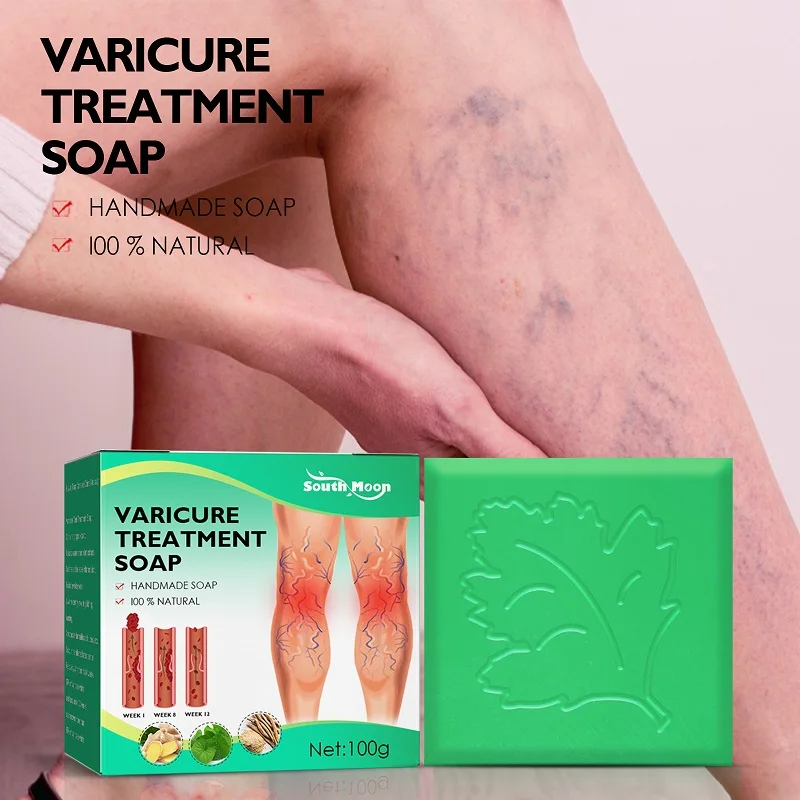 100g South Moon Ginger Varicure Treatment Soap Relieve Vasculitis Phlebitis Spider Pain Treatment Safety Cleaning Soap Body Care