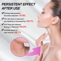 repair skin neck cream dilute neck wrinkles lifting firming neck cream shape swan neck moisturizing firming brightening 30g