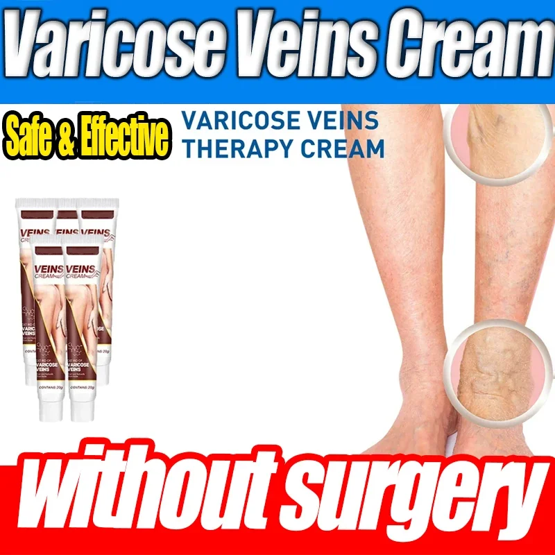 2024 аутентичный специальный медицинский гель для варикозного расширения вен
