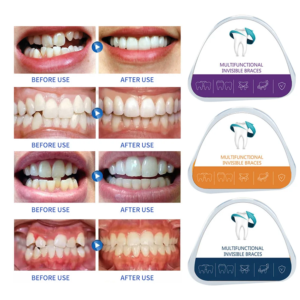 

3 Stages Dental Orthodontic Braces Teeth Corrector Brace Invisible Teeth Retainer Straighten Sport Tooth Protect Brace Oral Care