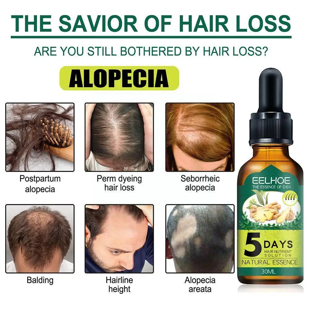 

1 Pcs Ginger Hair Regrowth Product Deeply Nourishes Prevents Hair Liquid Fall Care And Hair Nourishing Product Hair A2g7