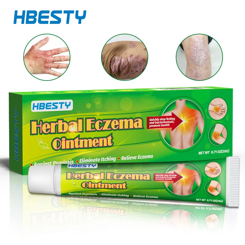 

20g HBESTY Herbal Ringworm Itching Cream Psoriasis Skin Shiduqing Herbal Care Cream