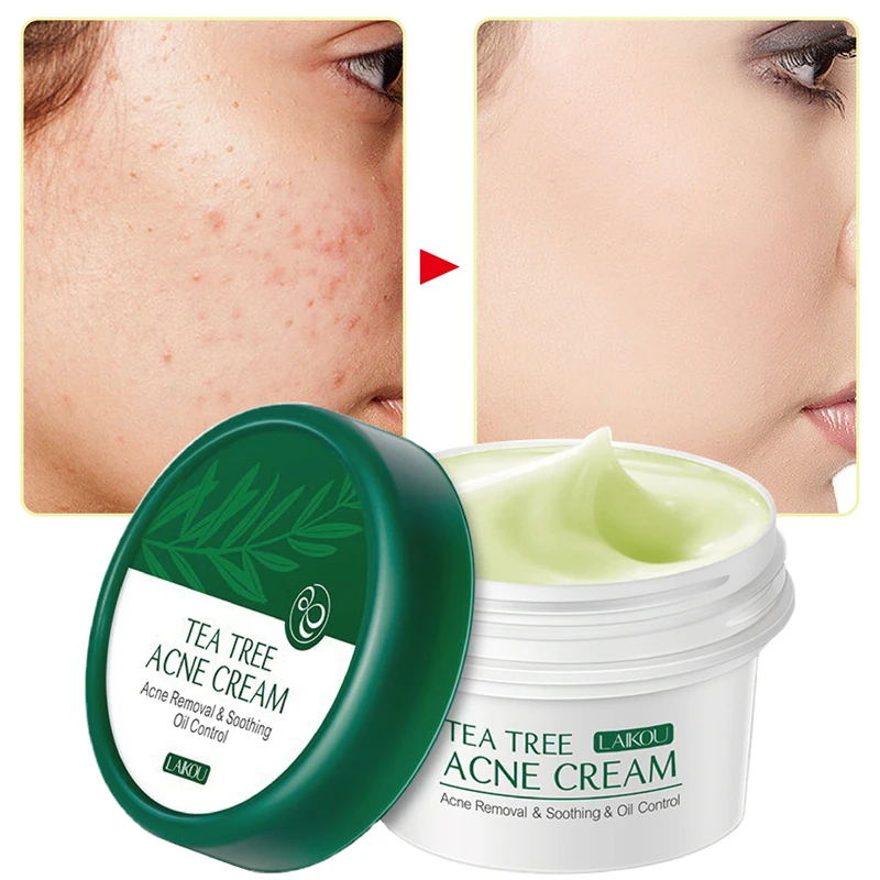 

Herbal Acne Treatment Cream Tea Tree Facial Essence Pimple Removal Shrink Pore Oil Control Moisturizing Facial Cream Skin Care