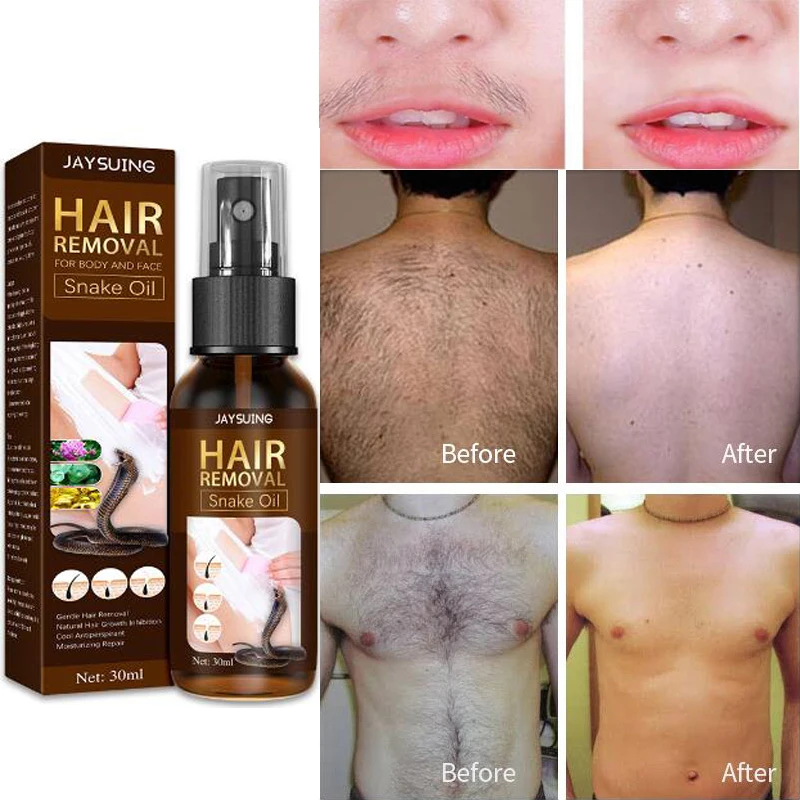 

Безболезненное перманентное змеиное масло спрей для удаления волос ингибитор роста волос для подмышек, для ног рук мужчин женщин мужчин пи...