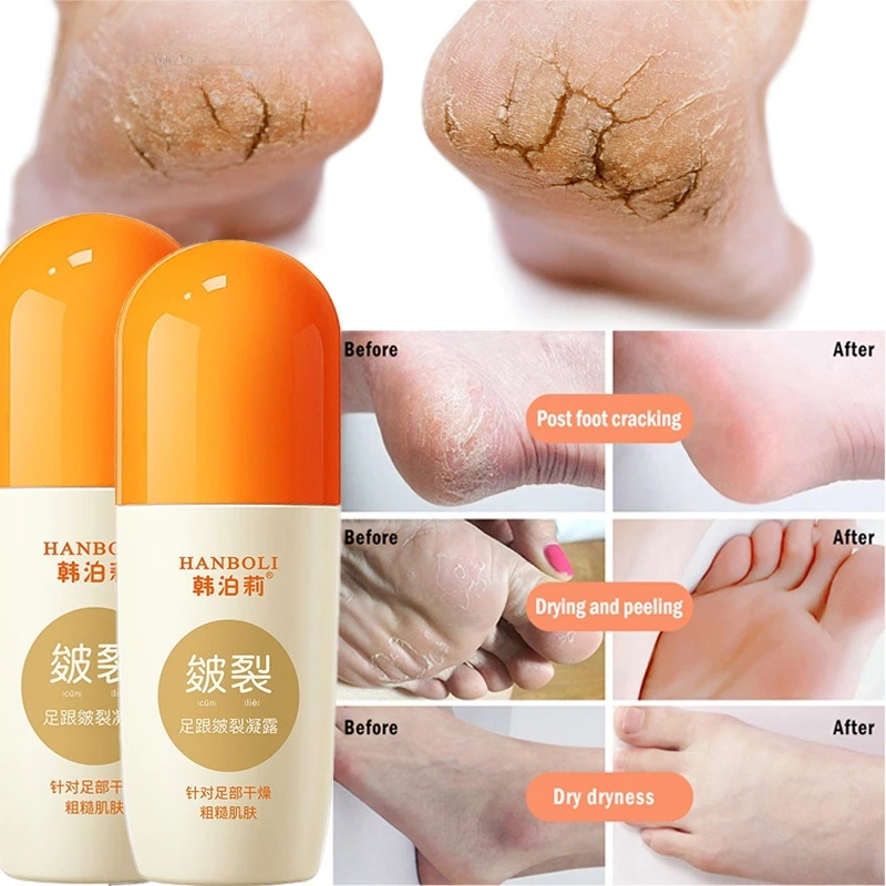 

Anti-Drying Crack Foot Cream Hand Cracked Repair Cream Removal Dead Skin Hand Feet Care Skin