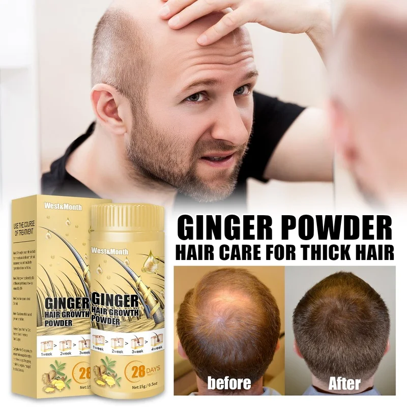 

Ginger Hair Growth Powder Poudre Perte Des Cheveux Scalp Treatments Caida Del Cabello Mujer Produit Pour Faire Pousser Les Soin