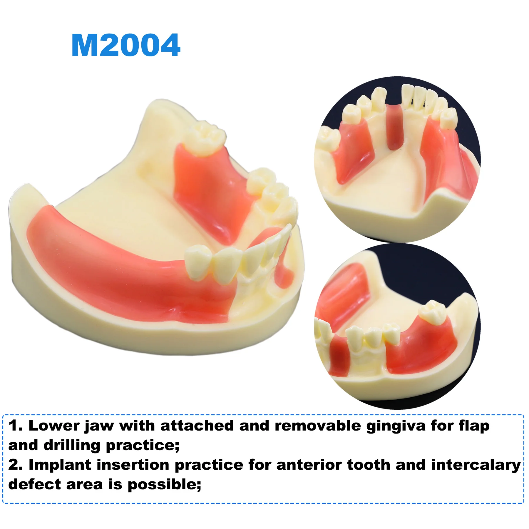 Модель зубного импланта модель для стоматологии тренировочный десен швы