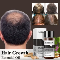 lanbena ginger hair growth product effective prevent hair loss serum essential oil hair care scalp treatment for men women 20ml