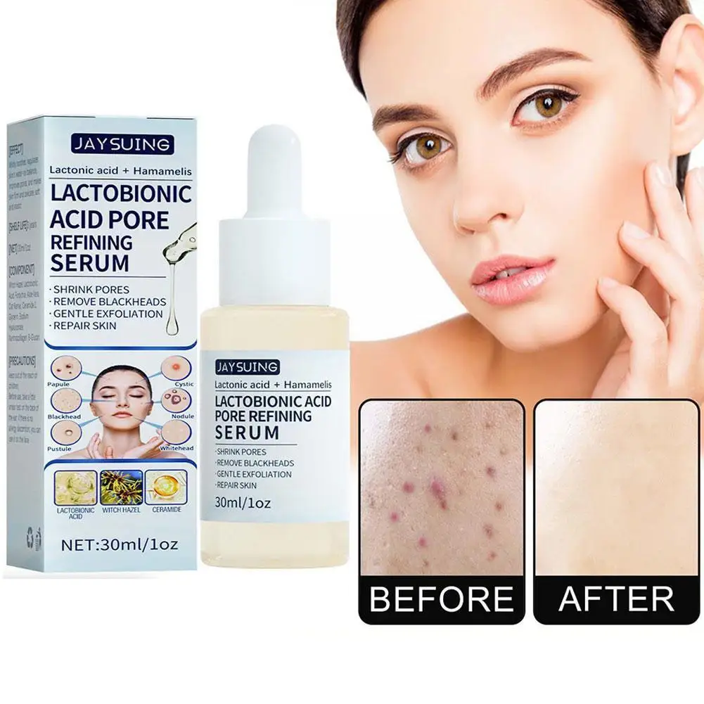 

Лактобионовая кислота, сыворотка для сужения пор, удаление черных точек, Корейская увлажняющая эссенция от акне, питает кожу, уход за кожей P K3C6