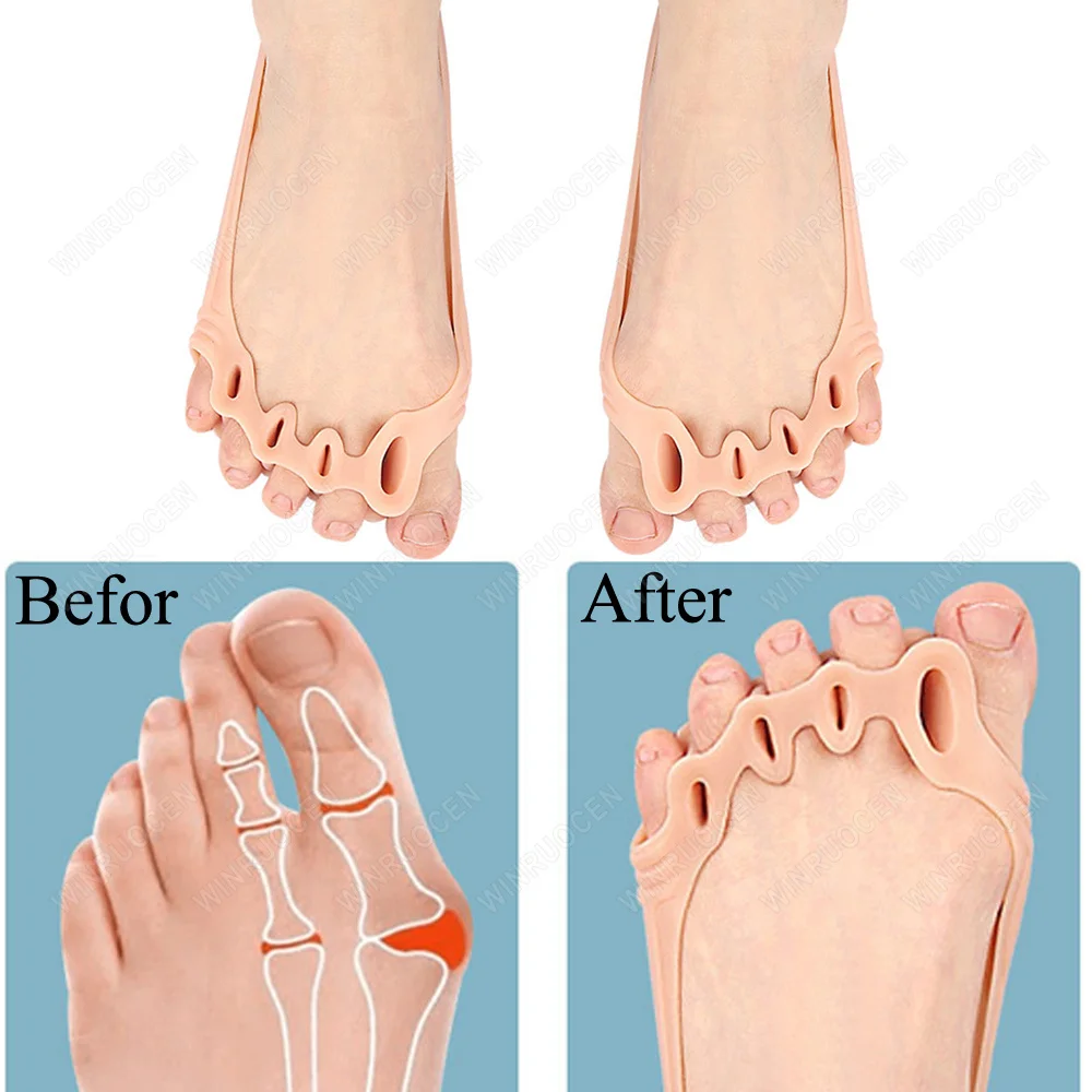 Силиконовые подушечки на пять пальцев корректор для восстановления боли