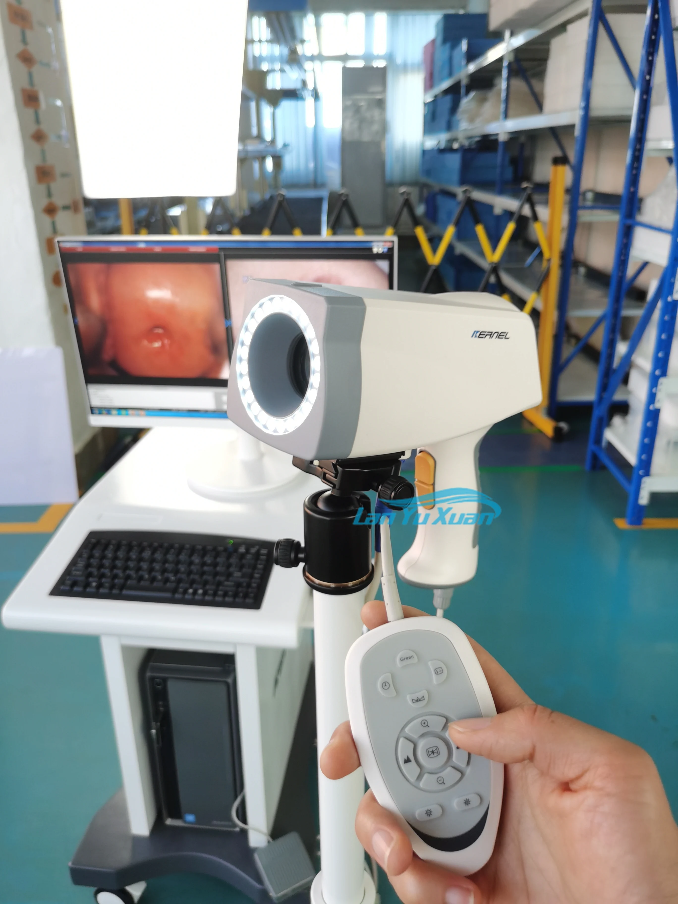 KN 2200 Полностью цифровой видеокольпоскоп Портативная система кольпоскопии