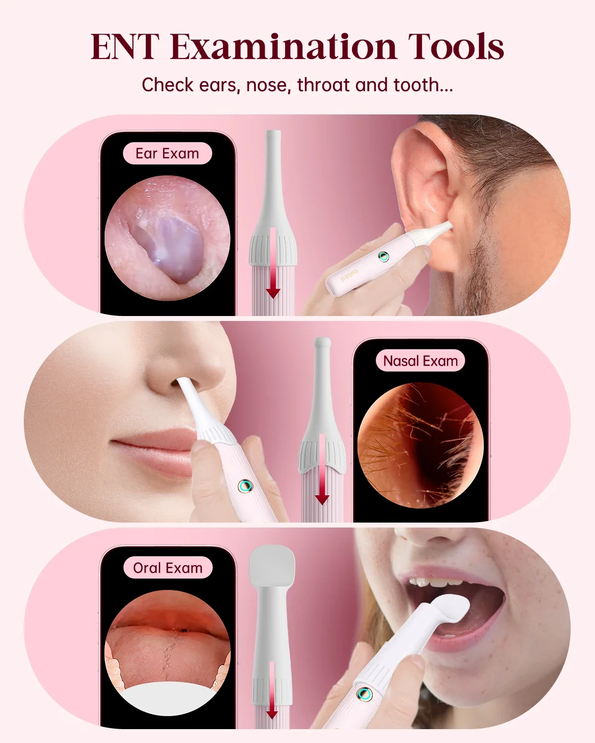 Фото [Розовый цвет] Bebird EarSight Plus I35R Visual Earpick Очиститель ушей Гибкие и доступные наборы для удаления ушной серы «все в 1» №3