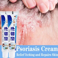 25g skin psoriasis cream relief redness dermatitis eczematoid eczema ointment treatment psoriasis skin care antibacterial cream