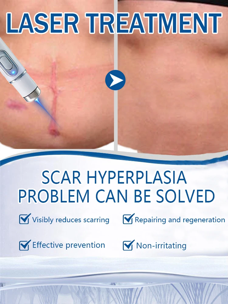 Лазерный продукт для решения проблем шрамов