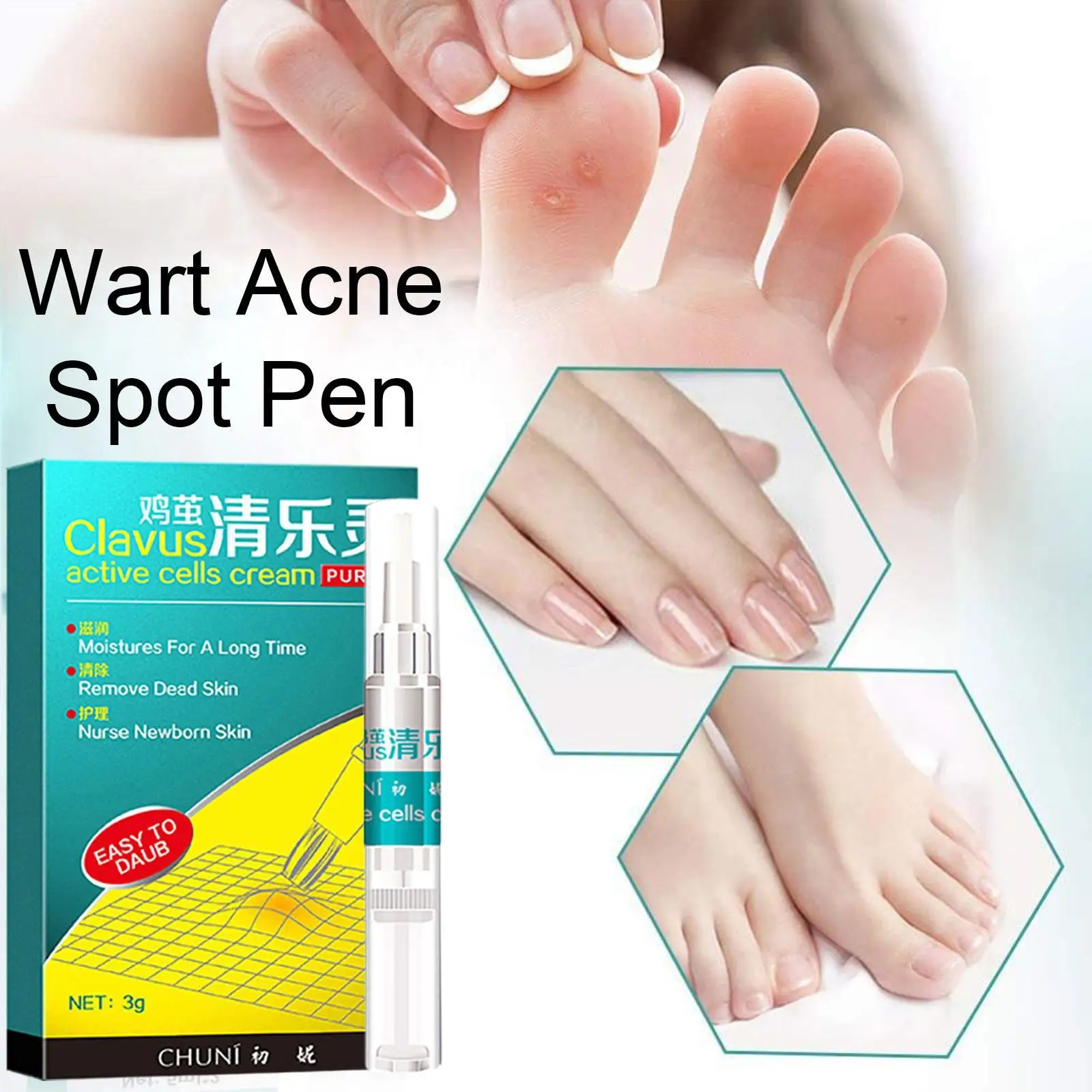

Chinese Medicine Treatment Skin Warts Removal Foot Corn Removal Plantar warts Pomada De Verruga Skin Care Medical Ointment