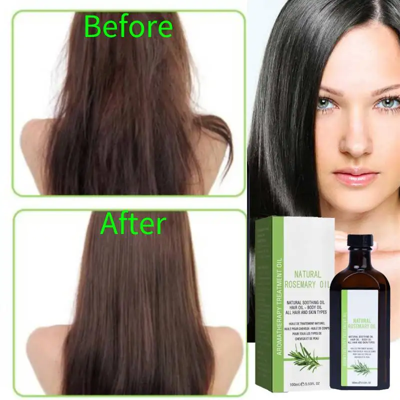 

Rosemary Hair Growth Serum Anti Hair Loss Products Fast Regrowth Essential Oil Repair Scalp Frizzy Thinning Damaged Hair Care