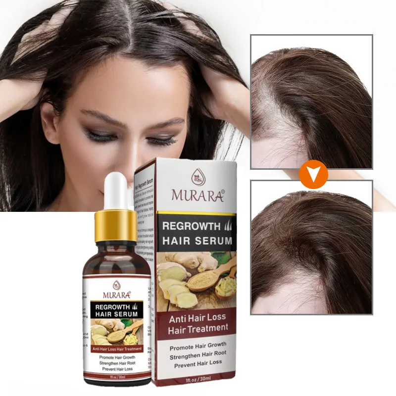 

Ginger Essence Hair Growth Products Fast Regrowth Oil Serum Hair Loss Medicine Enhancer Care Beauty Scalp Treatment 30ml