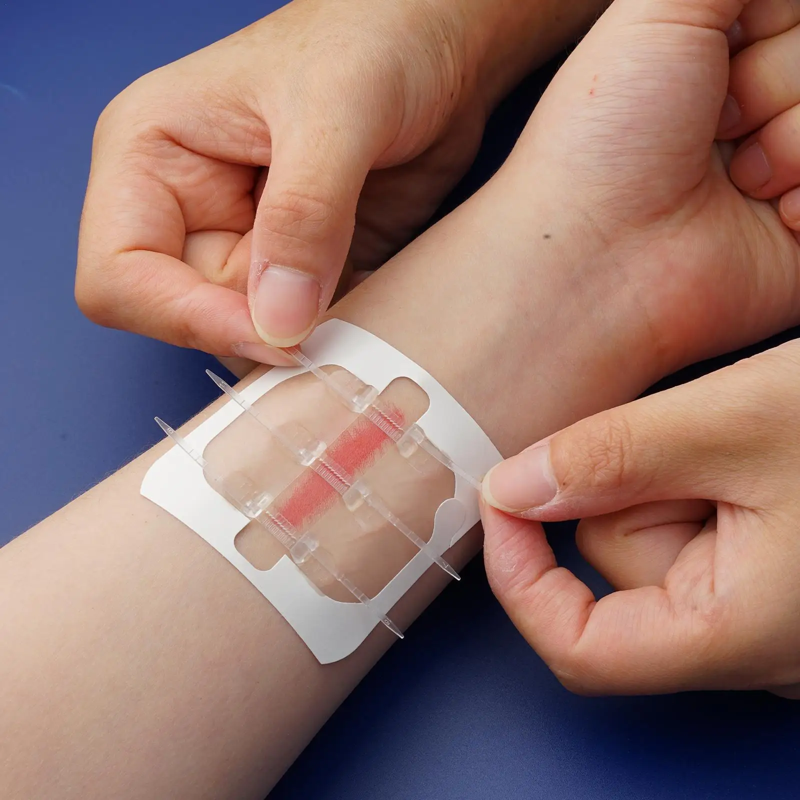 

Zipper Band-aid Painless Wound Closure Device Suture-free Wound Dressing Patches Zip Suture Reducer Band Aid