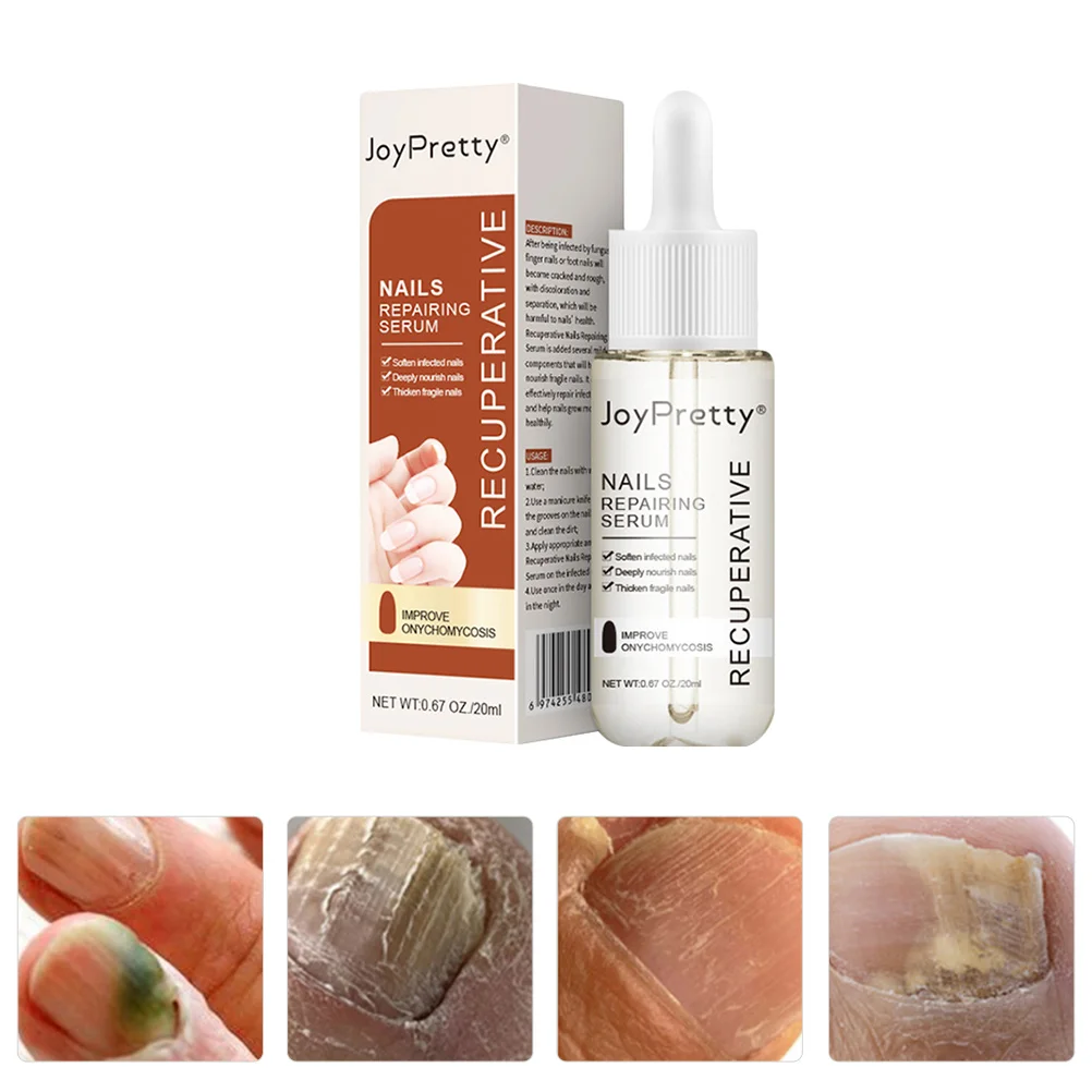 

Broken Nails Repair Toenails Care Solution Nail Repair Liquids Nails Care Supply Nail Repair Essence Frosted Fungal Nail Renewal