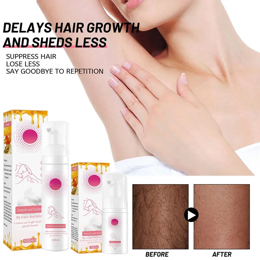

30/100ml Beeswax Hair Removal Mousse Fast Painless Foam Gentle No Smooth Spray Spots Black Armpit Body Leg Care Products Be S6B6