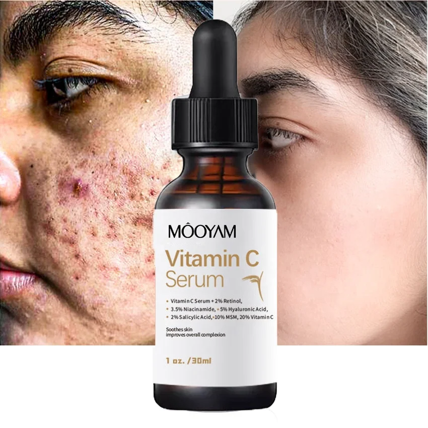 

20% Vitamin C Serum with 2% Retinol 3.5% Niacinamide 5% Hyaluronic Acid 2% Salicylic Acid 10% Brighten Spots Skin Face Essence