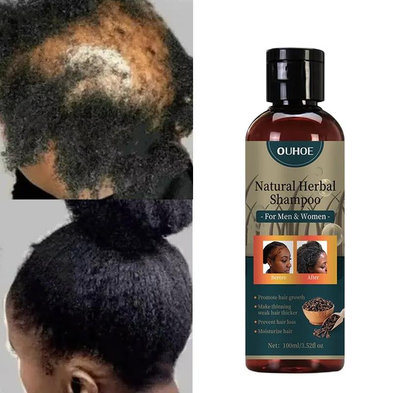Chebe Hair Growth Oil Shampoo Ancient African Formula Extract Essence Powerful Hair Loss Treatment Beauty Health Hair Care100ml
