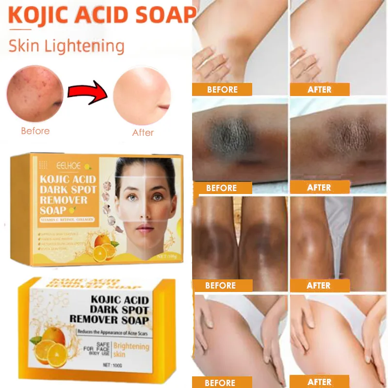 

Kojic Acid Soap Skin Dark Spot Whitening Lightening Brightening Anti Acne Organic Handmade Kojie San Bath For Face Body 100g