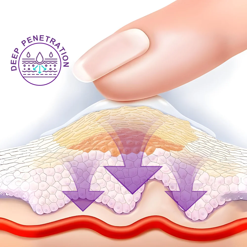 1/3/5/10/20 шт. крем для лечения герпеса пота снимает сверх кожи антибактериальная