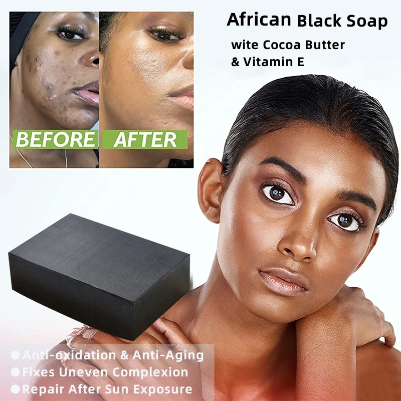 Vitamin E Bubbly Rich Skin Oil Control Soap For Face Body