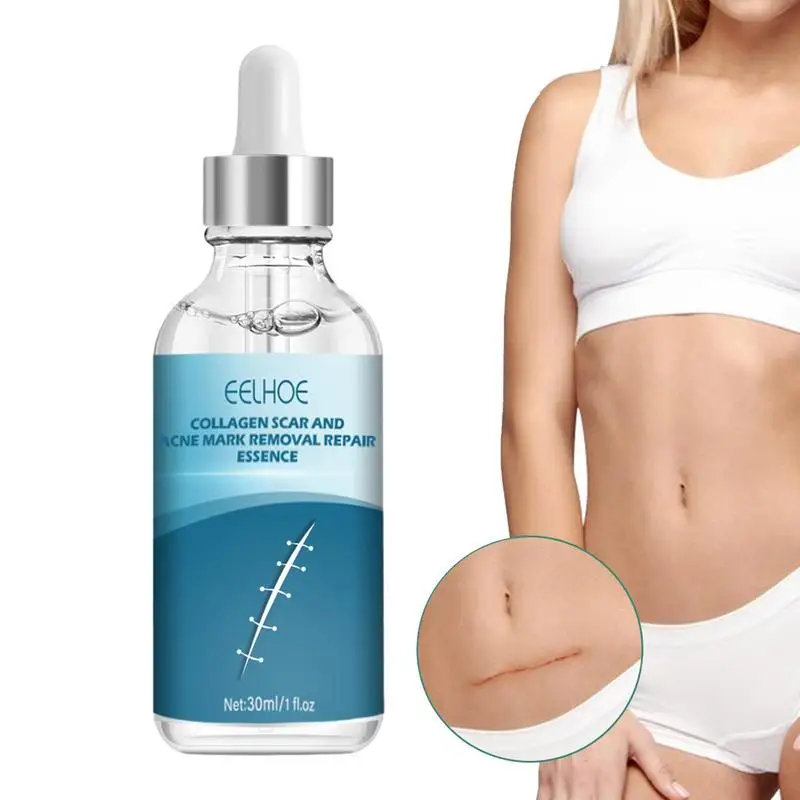 

Устройство для удаления пятен на лице