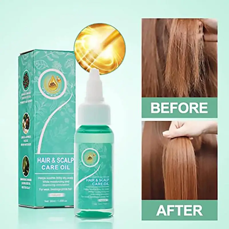 

Hair Growth Castor Oil Fast Grow Repair Scalp Frizzy Damaged Hair Care Hair Beauty Products For Women Men All Hair Types