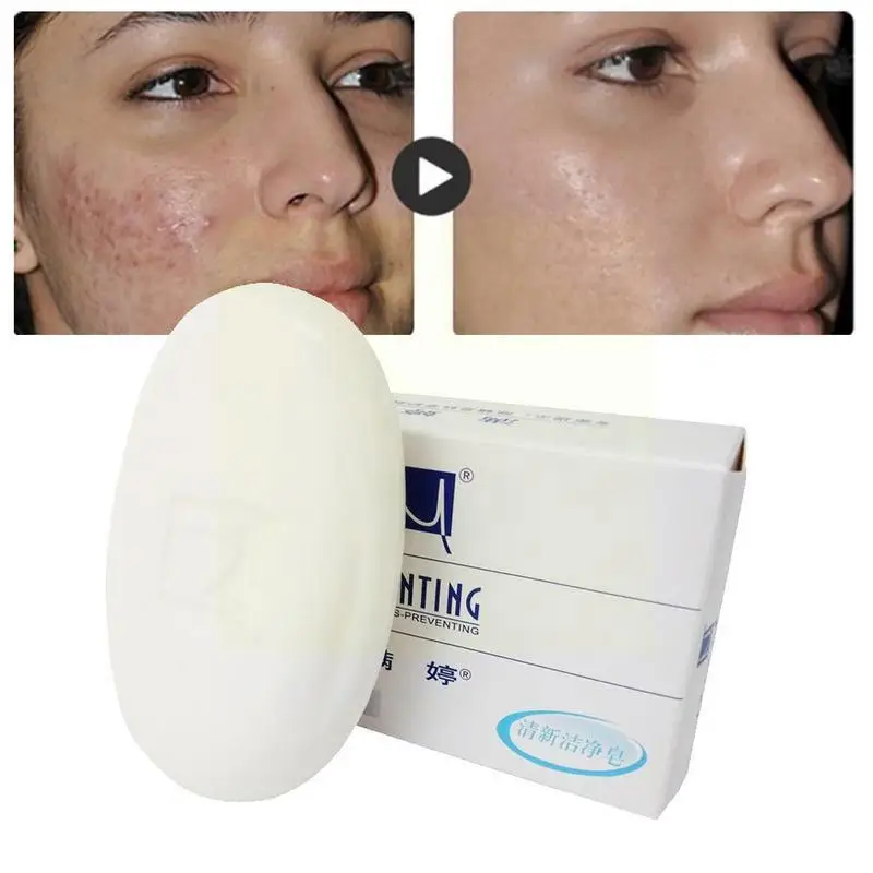 

Мыло для удаления клещей MANTING Acarus Acari, для тела, лица, устранения акне, свежее масло, мыло ручной работы, травяное мыло, уход N1W3