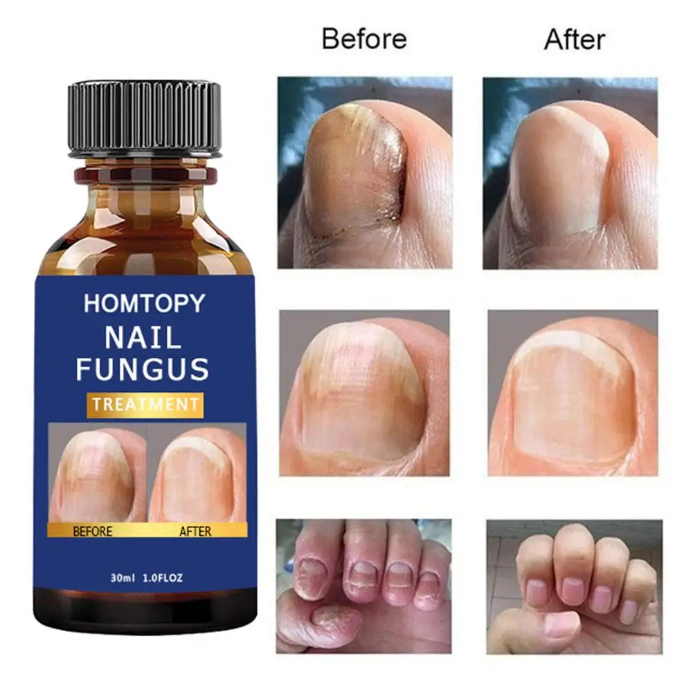 Рисунок 4 - Отвердитель для ногтей