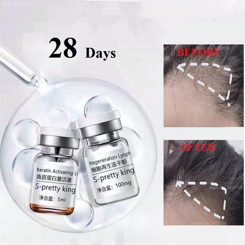 

Stem Cell Hair Growth Serum Anti Hair Loss 28 Days Fast Grow Prevent Thinning 2pcs/Set Hair Care Essence