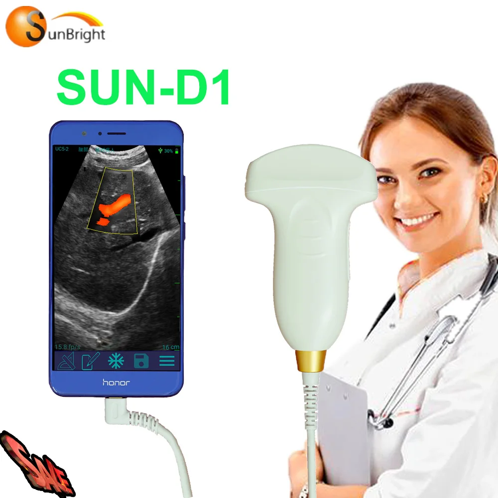 

Doctor clinic Cell phone connect USB port color doppler ultrasound USB convex probe