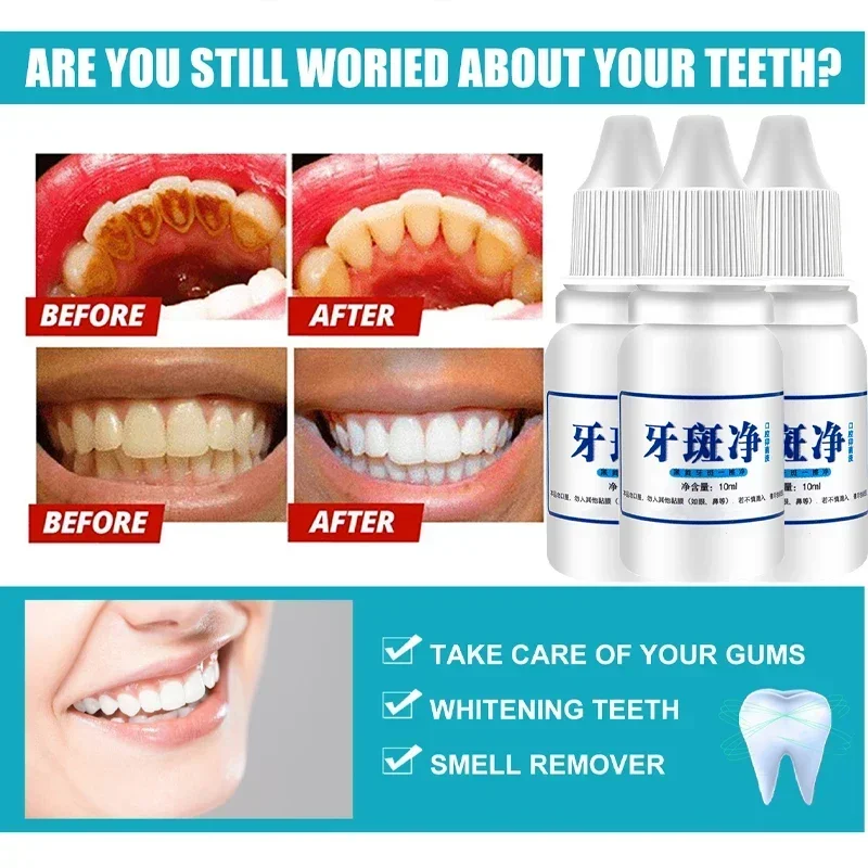 Эссенция для отбеливания зубов удаление зубного налета пятна отбеливание чистка