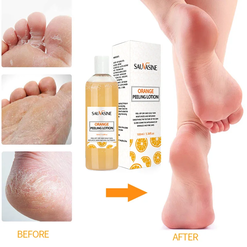 

Immediate Whitening Peeling Lotion Fnger Knee Armpit Dark Spots Body Brighten Reduce Melanin Even Skin Tone Hand and Foot Care