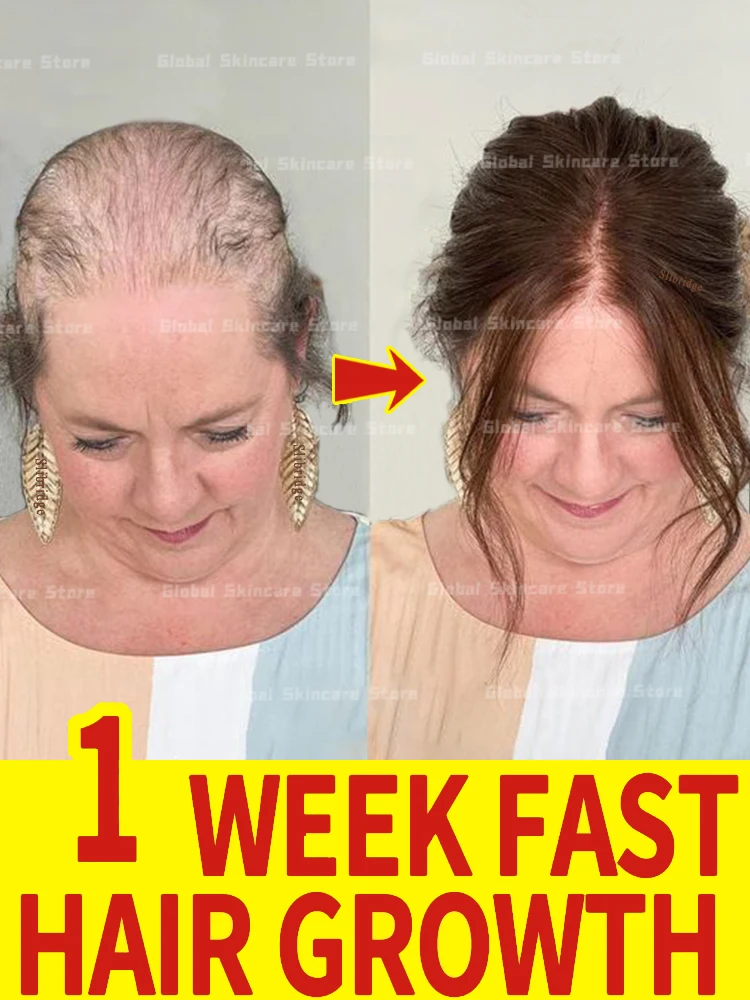 98% покупателей купить еще раз имейте больше и волосы посмотрите на облысение