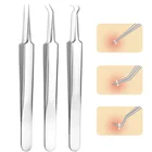 1 шт., инструмент для удаления черных точек