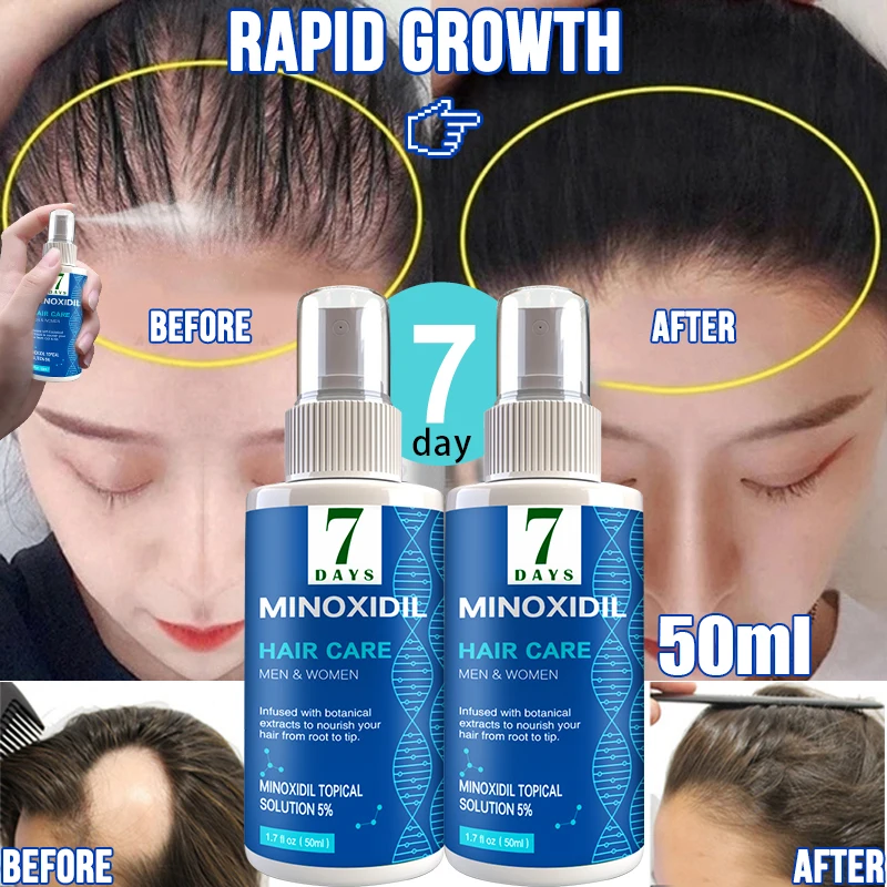 

7 DAYS Hair Growth Spray Anti Hair Loss Essential Fast Regrowth Prevent Hair Damaged Thinning Repair Care Scalp Treatment