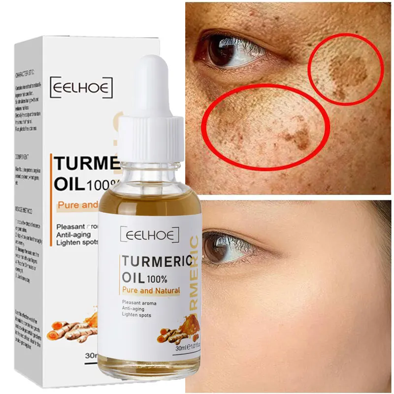 

30ml Turmeric Freckle Whitening Serum Curcumin Oil Brighten Fade Dark Spot Removal Pigment Melanin Correcting Face Skin Care