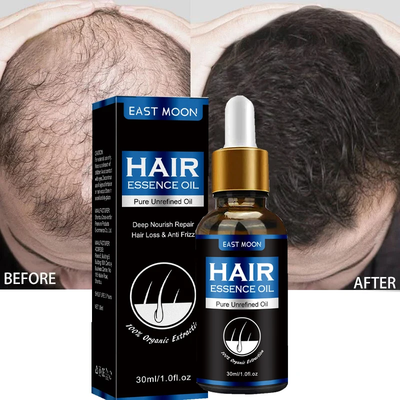 

Быстрое устройство для защиты от выпадения волос, восстановление филировки, питание корней волос, устройство для мужчин