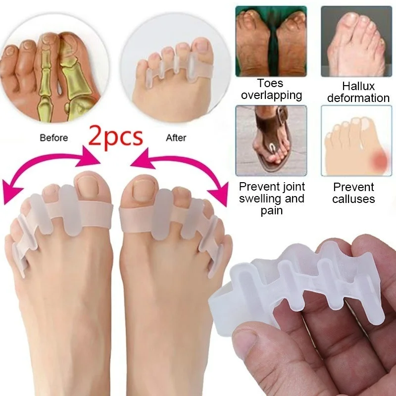 2pcs Feet Care Tool Toe Separator Overlapping Toes Rehabilitation Treatment Hallux Valgus Braces Foot Bone Orthotic Device